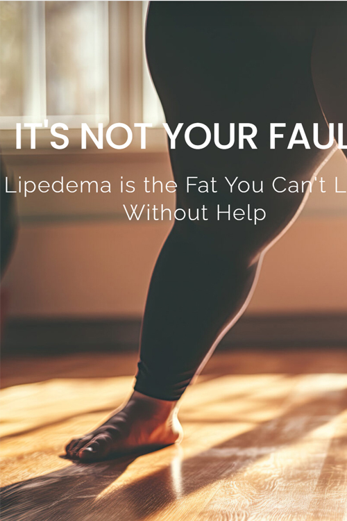 Lipedema Lipedema website development
